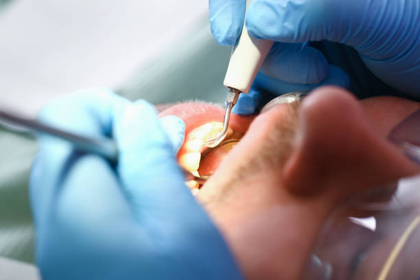 Best Pediatric Emergency Dentist in Verona, VA